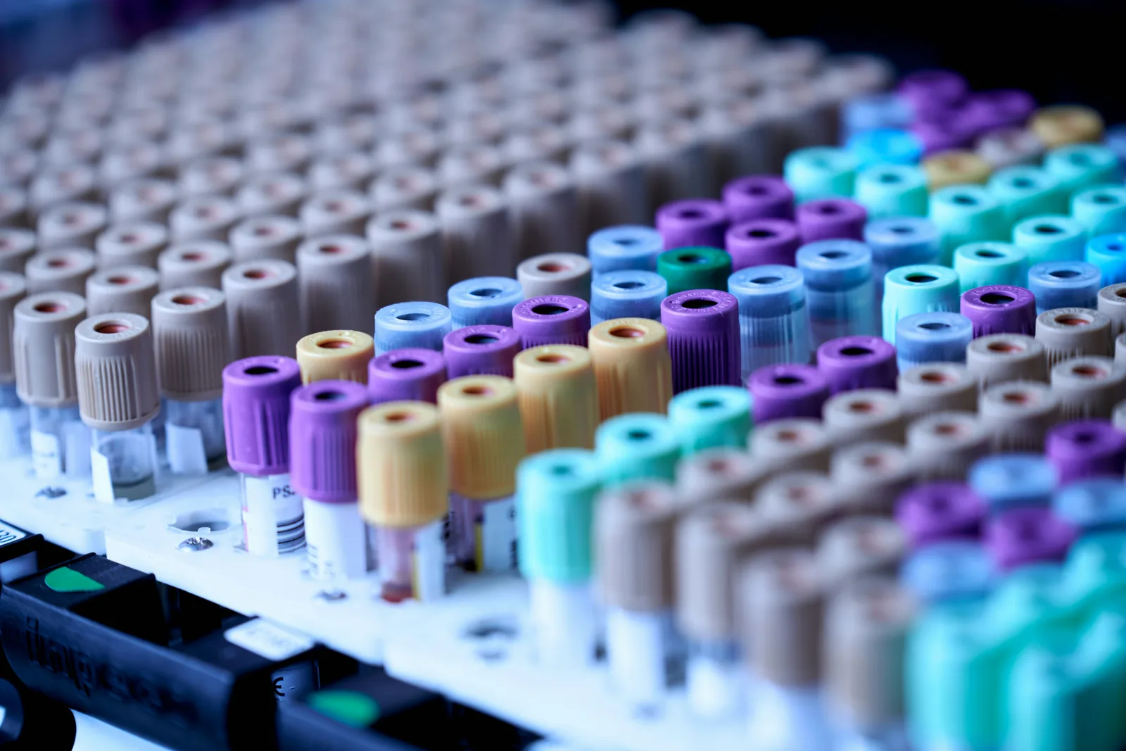 Racks of color-capped laboratory sample tubes representing laboratory consumable imports